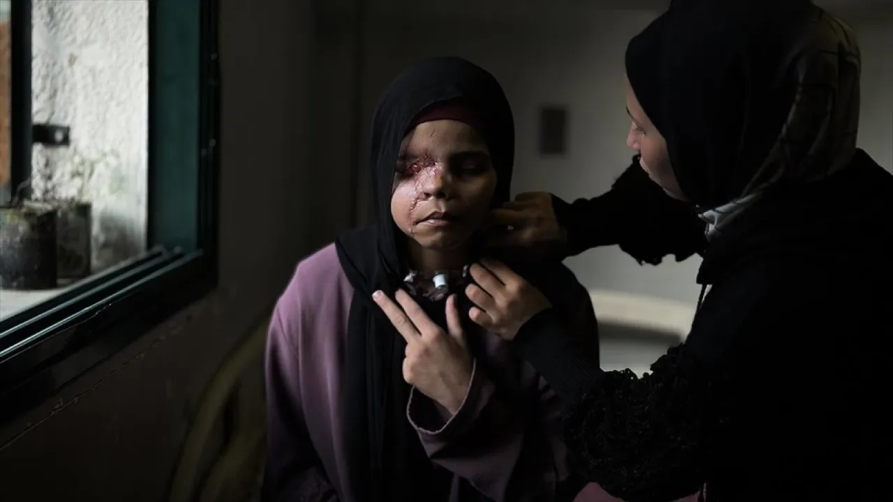 İsrail saldırısı nedeniyle yüzü tanınmaz hale gelen 15 yaşındaki Gazzeli Neda'nın "hayatı karardı"