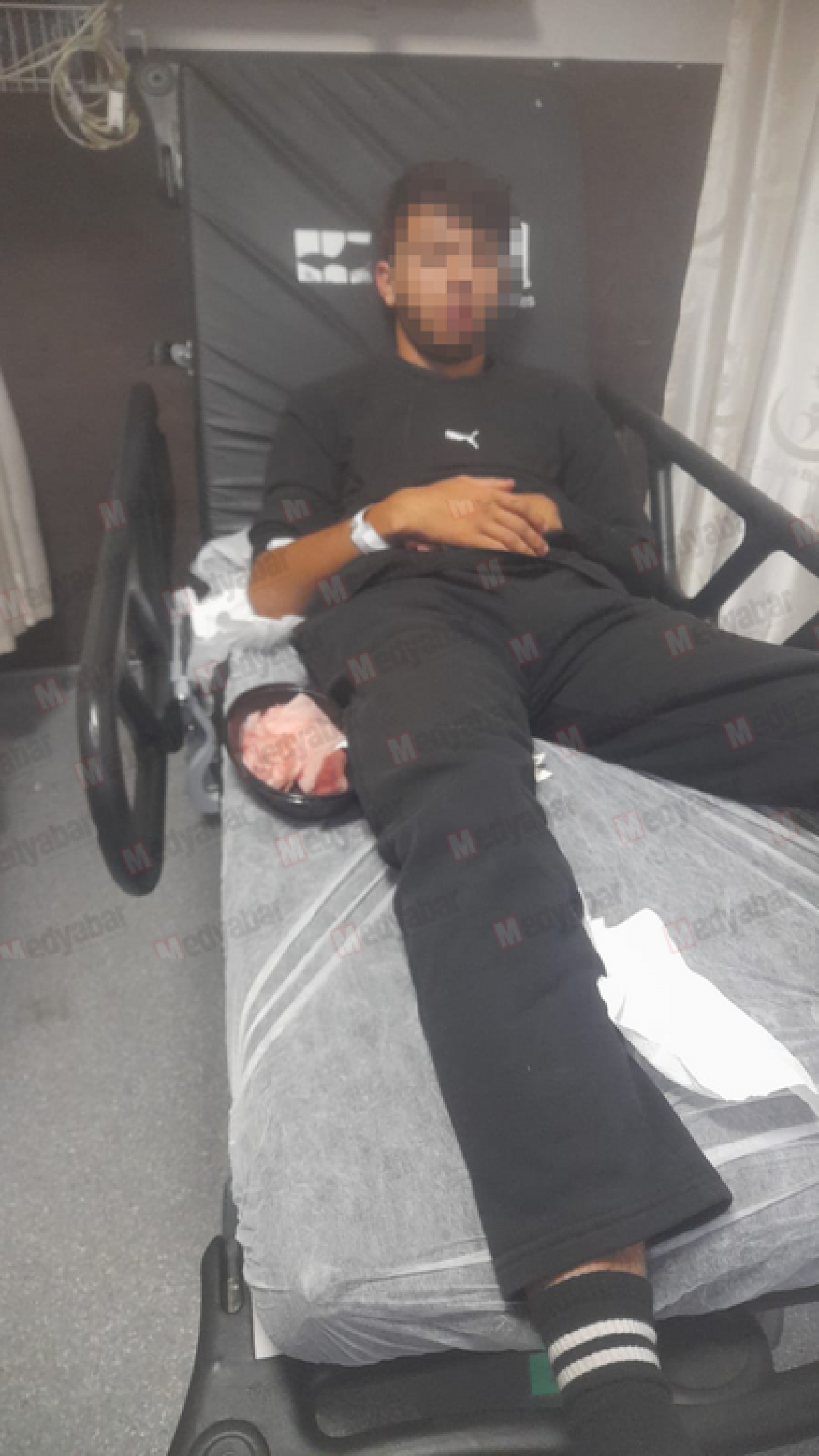Kız kavgasında 18 yaşındaki gencin çenesini kırıp bir de kaydettiler!