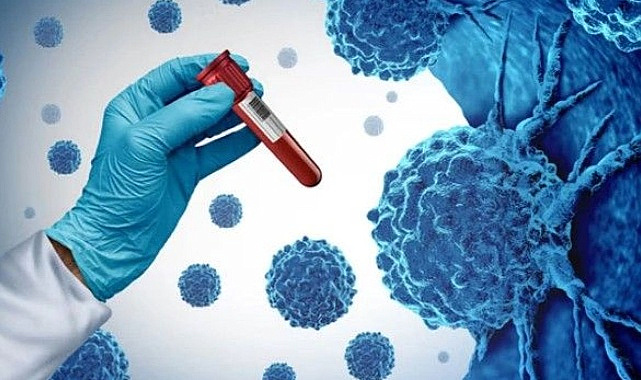 Sakarya’da Her 100 Ölümün 18’i Kanser Kaynaklı