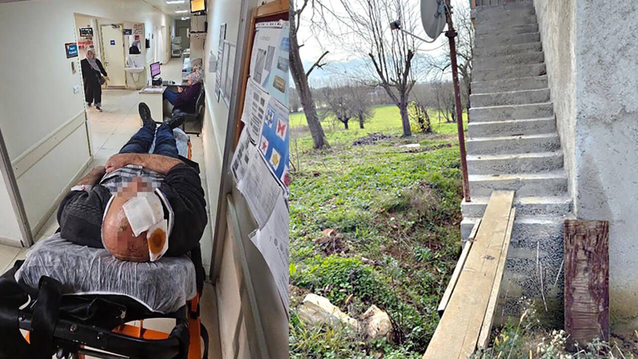 Sakarya’da merdivenden düşen şahıs yaralandı